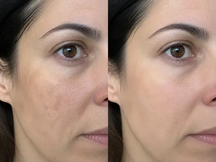 Antes y después tras 8 semanas