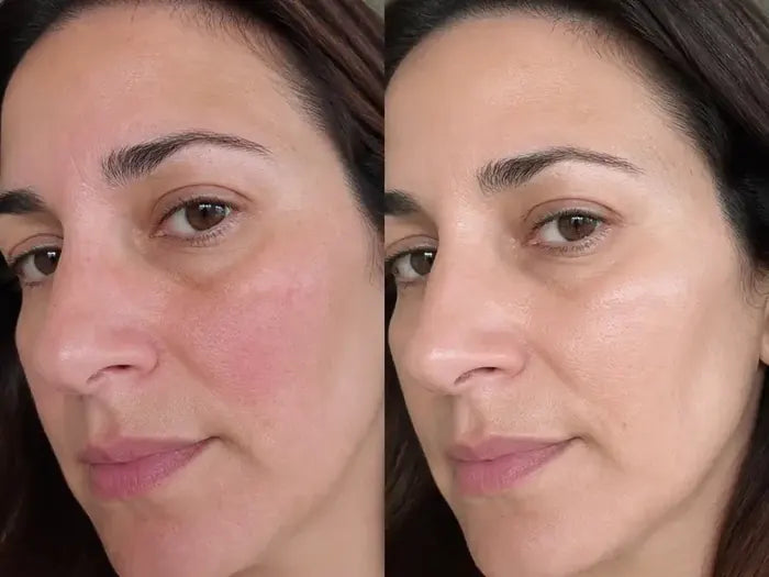 Antes y después tras 5 semanas