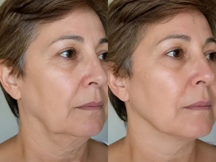 Antes y después tras 8 semanas