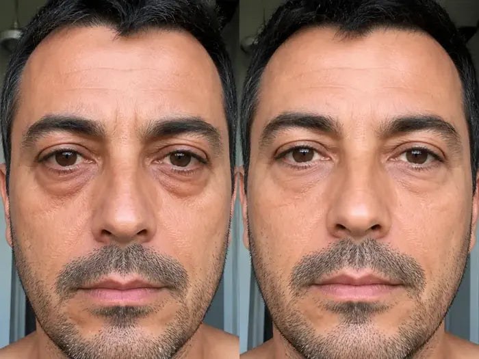 Antes y después tras 5 semanas