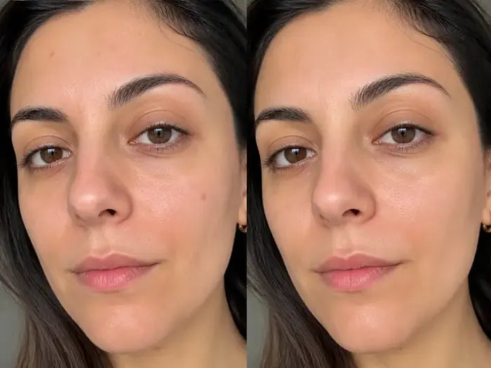 Antes y después tras 5 semanas