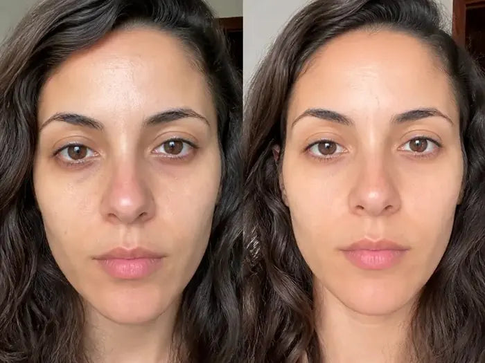 Antes y después tras 5 semanas